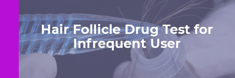 How to Pass a Hair Follicle Drug Test - High Times